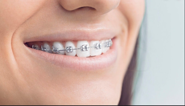 Tooth bracelet best sale